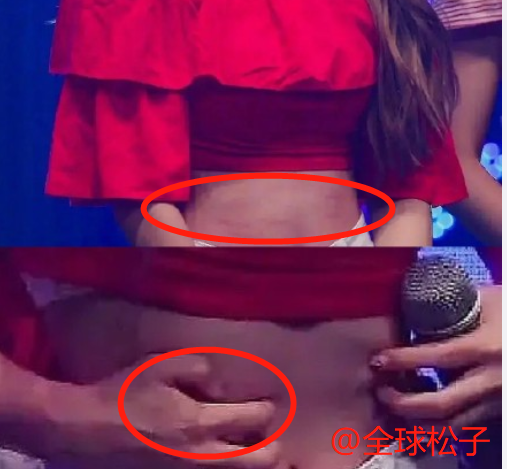 够狠！苞娜跳舞时故意抓伤恩熙，细节图：手指