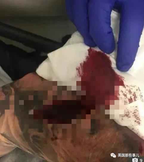 高调炫富后遭遇入室抢劫，劫匪：这货根本没那