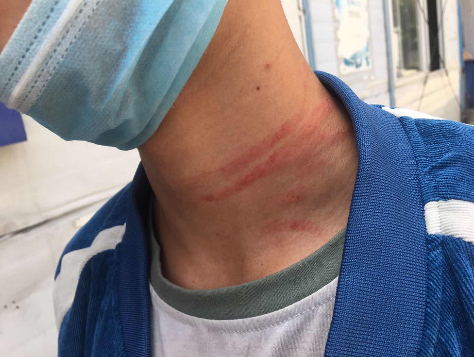 贵阳一外卖小哥被当街暴打，打人者很嚣张，原