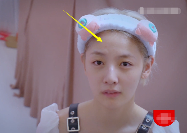 《创造营》素颜：赵粤痘痘明显，刘梦黑眼圈严