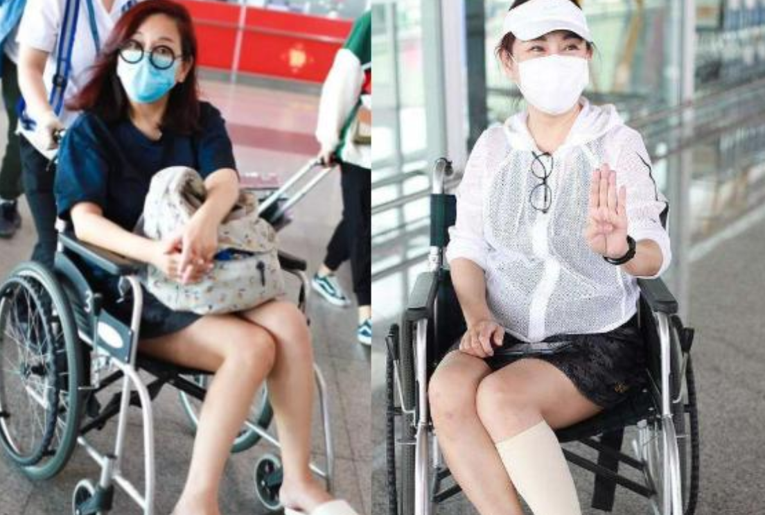 黄圣依头部受伤!鲜血浸湿纱布已送医,《浪姐