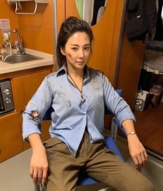 黄圣依头部受伤!鲜血浸湿纱布已送医,《浪姐