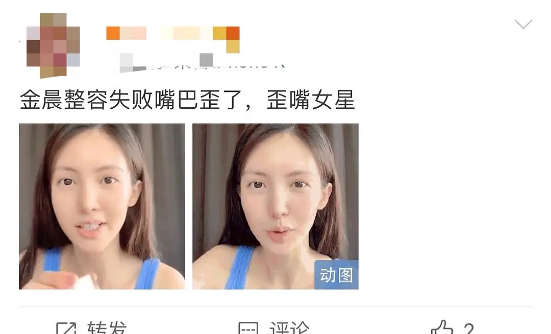 被黑“整容失败”？金晨霸气回应歪嘴，天生丽
