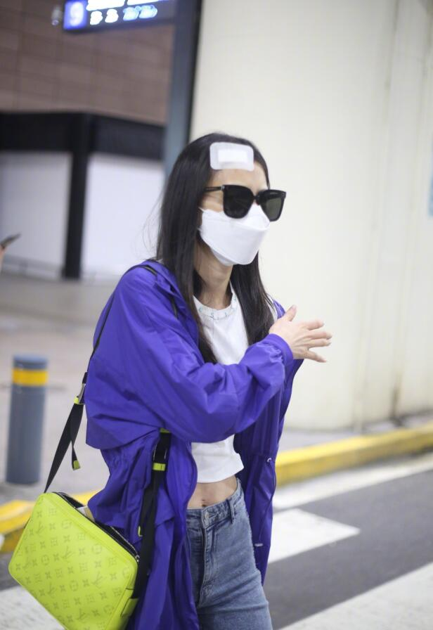 黄圣依拍戏头部受伤后现身，头顶纱布录影超敬