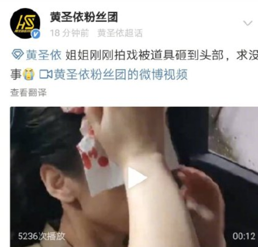 黄圣依被道具砸伤流血！豪门阔太复出艰辛，真