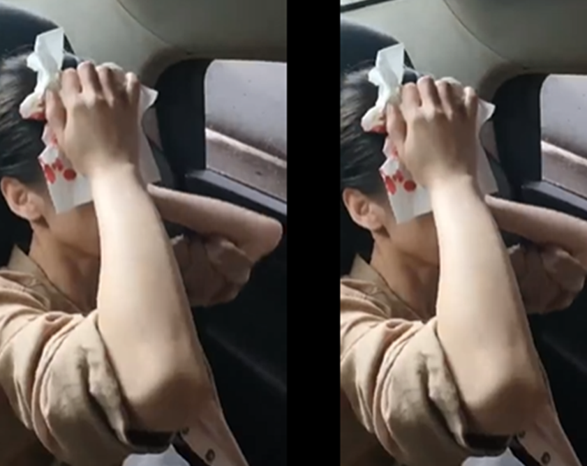 黄圣依被道具砸伤流血！豪门阔太复出艰辛，真