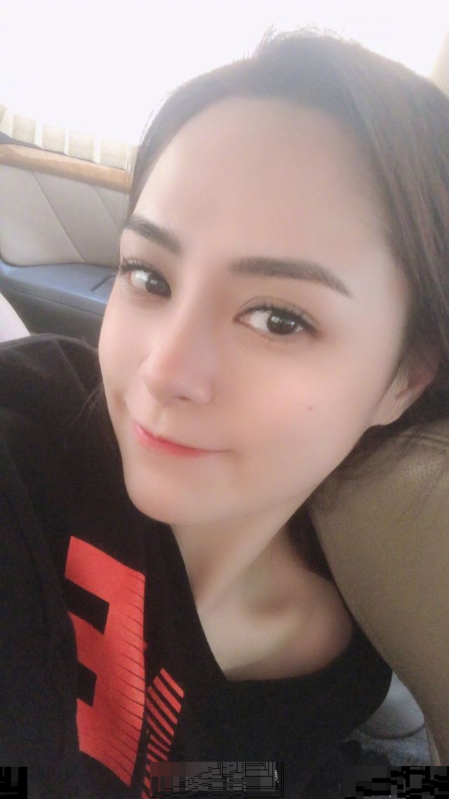 阿娇头部受伤最新情况曝光，赖弘国迅速回应，