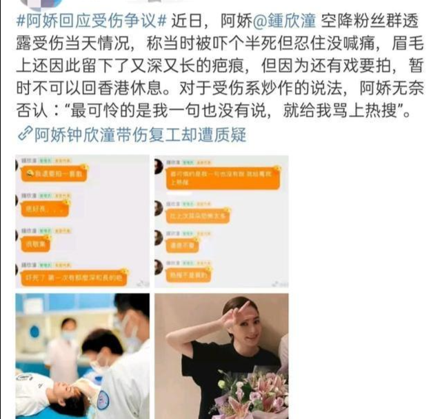 真留疤了!阿娇复工超敬业戴帽子口罩遮遮掩掩