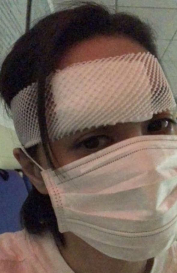 真留疤了!阿娇复工超敬业戴帽子口罩遮遮掩掩