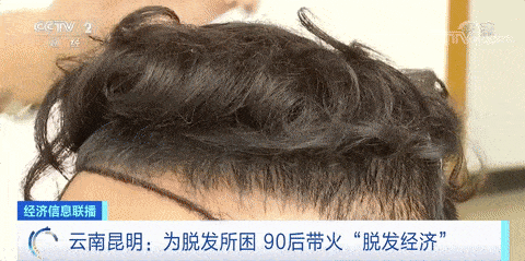 中国平均6人中就有1人脱发，植发群体超半数为