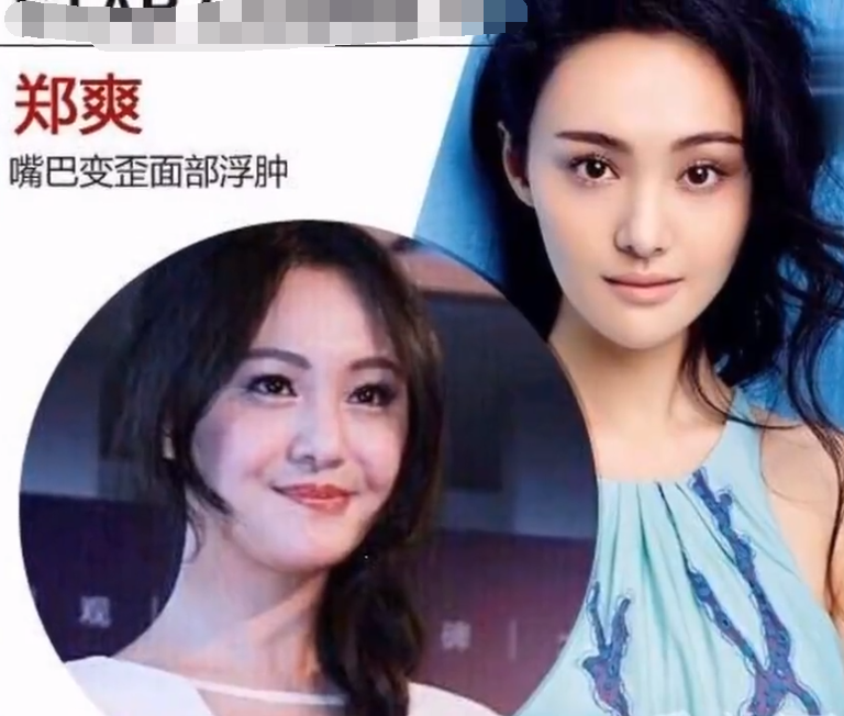 郑爽又变脸了？新视频眼袋重眼睛肿显憔悴，还