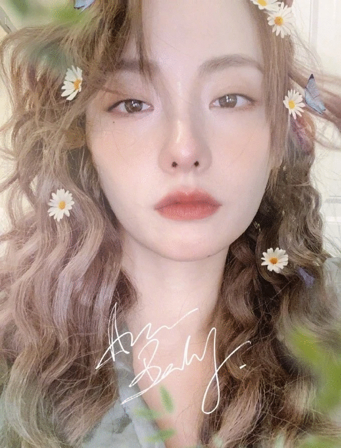 ​坐轮椅现机场，张嘉倪怎么了？