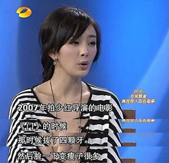 昔日偶像杨幂说拔智齿能瘦脸,郑爽却质疑,评
